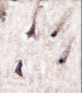 PKC beta2 Antibody (C-term)